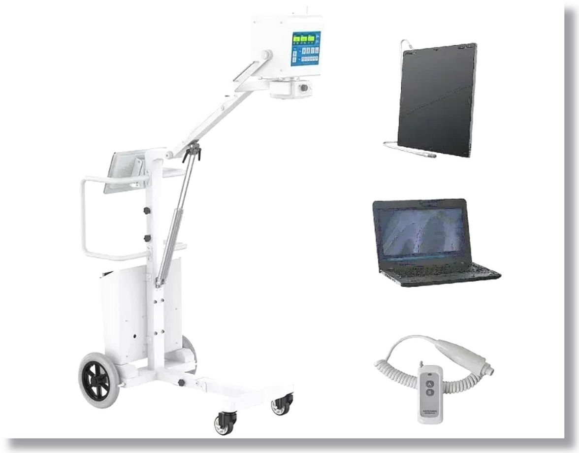 5kW Mobile Digital Radiography X-ray System by MAIKONG CO.LTD: A Cutting-Edge Solution for Mobile Medical Imaging